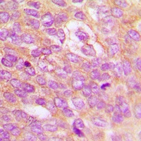 IKK beta (Phospho-Y199) Rabbit Polyclonal Antibody