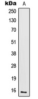IL-2 Rabbit Polyclonal Antibody