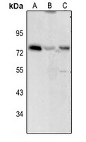 CD122 Rabbit Polyclonal Antibody