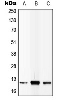 IL-4 Rabbit Polyclonal Antibody