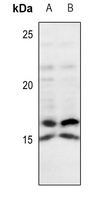 IL-4 Rabbit Polyclonal Antibody