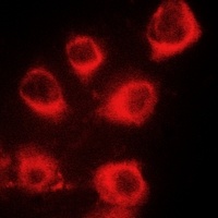 MYL9 (Phospho-S20) Rabbit Polyclonal Antibody