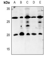 IL-5 Rabbit Polyclonal Antibody