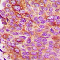 IL-5 Rabbit Polyclonal Antibody