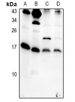 IL-5 Rabbit Polyclonal Antibody
