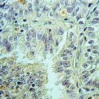IL-5 Rabbit Polyclonal Antibody