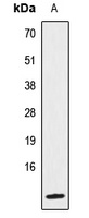 IL-8 Rabbit Polyclonal Antibody