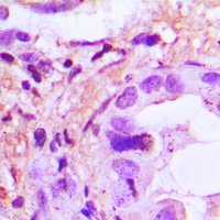 IL-8 Rabbit Polyclonal Antibody