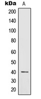 IL-12B Rabbit Polyclonal Antibody
