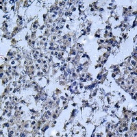 IL-12B Rabbit Polyclonal Antibody
