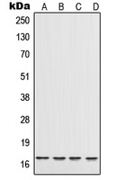 IL-17 Rabbit Polyclonal Antibody