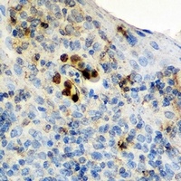 IL-17 Rabbit Polyclonal Antibody