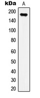 IRS1 (Phospho-S307) Rabbit Polyclonal Antibody