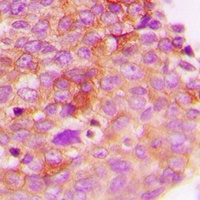 IRS1 (Phospho-S307) Rabbit Polyclonal Antibody
