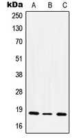 CD49e LC Rabbit Polyclonal Antibody