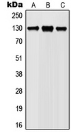 JAK1 (Phospho-Y1022) Rabbit Polyclonal Antibody