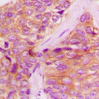 JAK1 (Phospho-Y1022) Rabbit Polyclonal Antibody