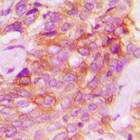 JAK1 Rabbit Polyclonal Antibody
