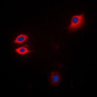 JAK1 Rabbit Polyclonal Antibody