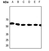 Kv1.1 Rabbit Polyclonal Antibody