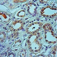 Kv1.1 Rabbit Polyclonal Antibody