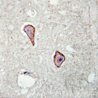 Kv1.3 (Phospho-Y187) Rabbit Polyclonal Antibody