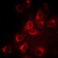 Kv1.3 (Phospho-Y187) Rabbit Polyclonal Antibody