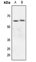 Kv1.3 Rabbit Polyclonal Antibody