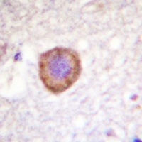 Kv1.3 Rabbit Polyclonal Antibody