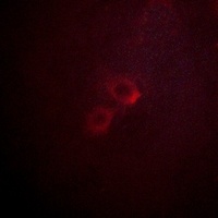 Kv1.3 Rabbit Polyclonal Antibody