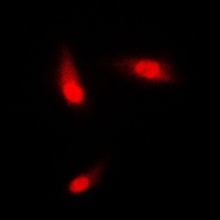 Cytokeratin 8 Rabbit Polyclonal Antibody