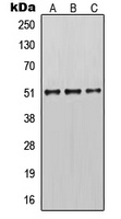Cytokeratin 14 Rabbit Polyclonal Antibody