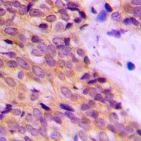 Cytokeratin 14 Rabbit Polyclonal Antibody