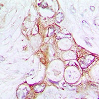 Laminin alpha 5 Rabbit Polyclonal Antibody