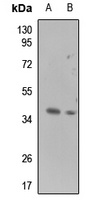 Galectin 9 Rabbit Polyclonal Antibody