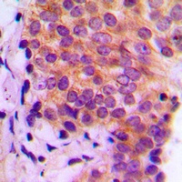 Galectin 9 Rabbit Polyclonal Antibody