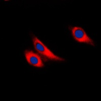 Galectin 9 Rabbit Polyclonal Antibody