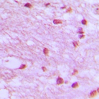 DNA Ligase 4 Rabbit Polyclonal Antibody