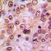 LIMK1/2 (Phospho-T508/505) Rabbit Polyclonal Antibody