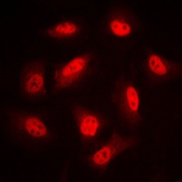 LIMK1/2 (Phospho-T508/505) Rabbit Polyclonal Antibody