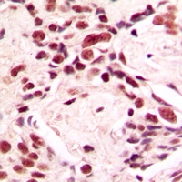 Lamin A/C Rabbit Polyclonal Antibody