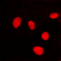 Lamin A/C Rabbit Polyclonal Antibody