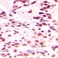 Lamin A/C Rabbit Polyclonal Antibody