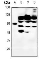 Lamin A/C Rabbit Polyclonal Antibody