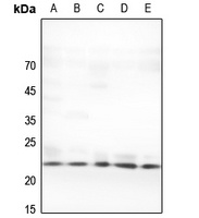 TNF beta Rabbit Polyclonal Antibody