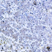 TNF beta Rabbit Polyclonal Antibody