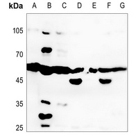 LTBR Rabbit Polyclonal Antibody