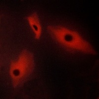 LTBR Rabbit Polyclonal Antibody