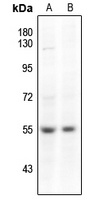 SMAD3 (Phospho-S204) Rabbit Polyclonal Antibody