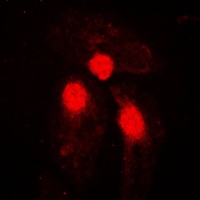 SMAD3 (Phospho-S204) Rabbit Polyclonal Antibody